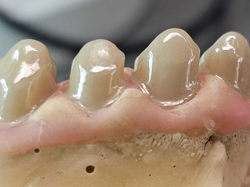 Fixní primární teleskop ZrO2