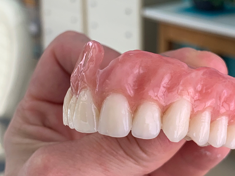 Snímatelná nadstandardní CSN